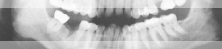 Dentalhygiene Herisau